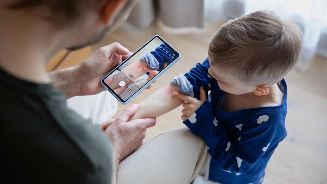 Isä ottaa kuvaa lapsen ihottumasta terveyden etäasiointipalvelua varten.